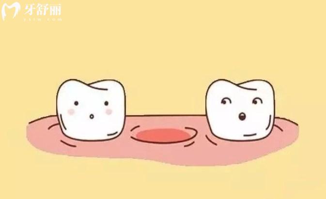 牙齿缺失
