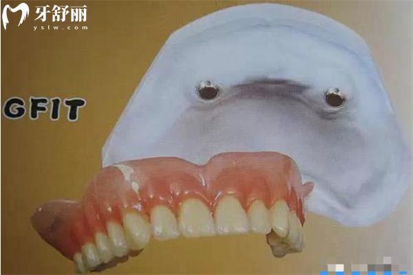 假牙镶牙