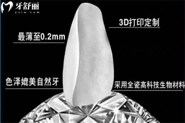 全瓷材质
