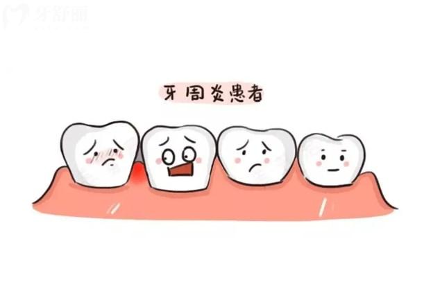 牙周炎