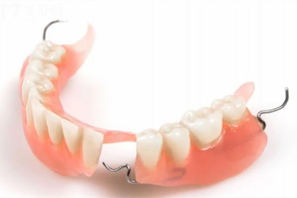 种植牙和活动牙的区别在哪里