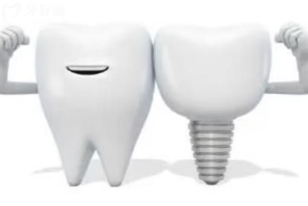 牙槽骨薄可以种植牙吗？牙槽骨薄是什么原因导致的？