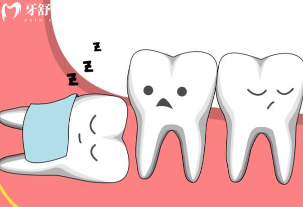 智齿能代替坏的后槽牙吗