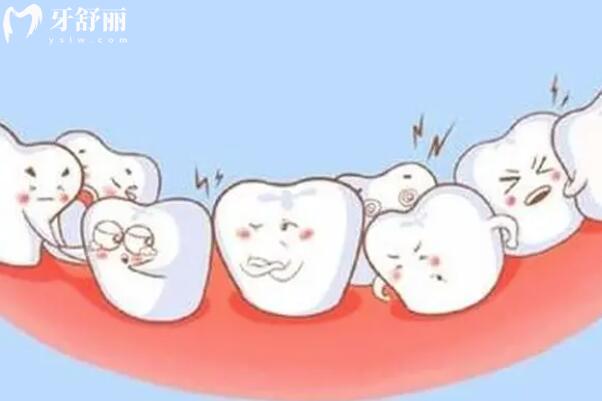 导致双排牙齿的原因是什么？双排牙齿要拔掉吗？