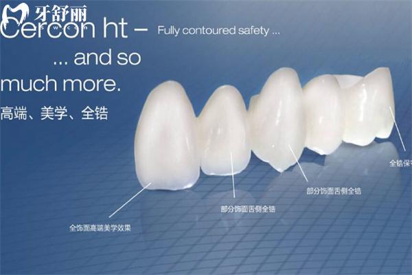 德国泽康(Cercon)全瓷牙冠