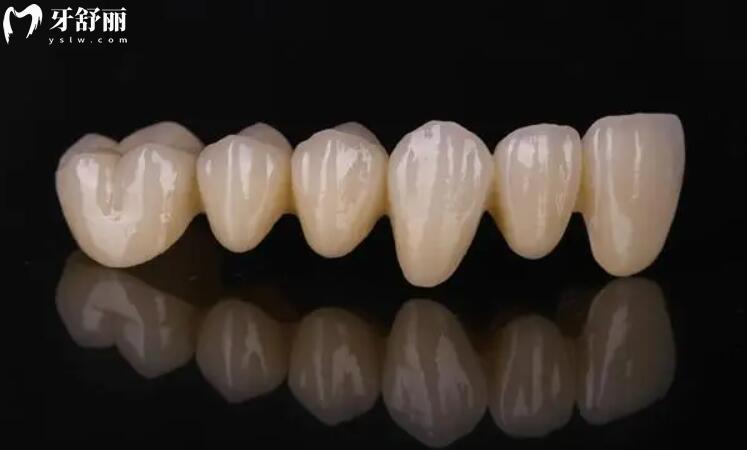 贵阳牙博士口腔收费高吗?2025年全新价格一览:种牙/矫正/补牙多少钱 贵阳牙博士口腔收费高吗?2025年全新价格一览:种牙/矫正/补牙多少钱