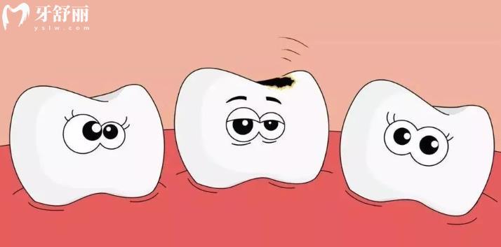 一颗牙齿松动会引起其他牙齿松动吗