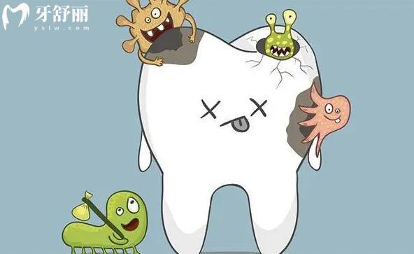 牙齿龋坏如何判断该不该做根管治疗?主要查看这几方面