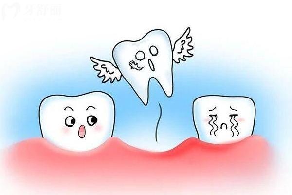 50岁牙齿晃动是变老的开始吗？缺牙了该怎么修复？