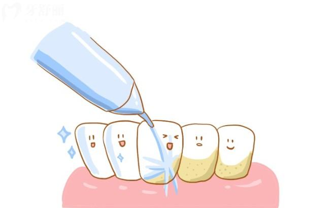 洗牙会损伤牙齿吗
