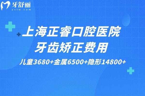 上海正睿口腔医院牙齿矫正费用公布:儿童3680+金属6500+隐形14800+