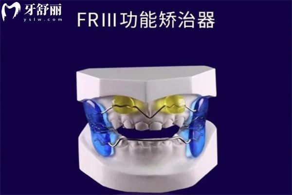 FR-III型矫治器