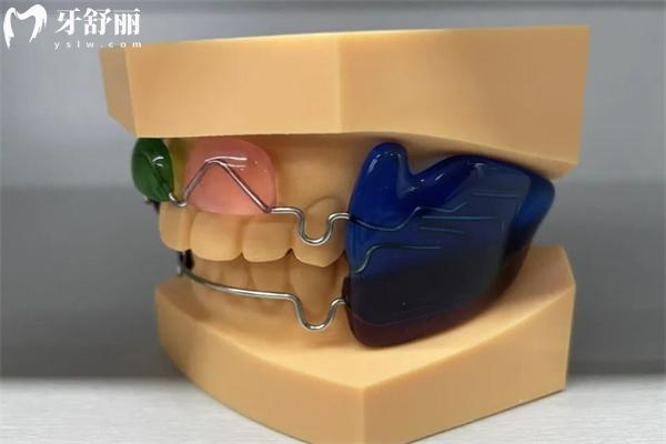 Frankel功能矫治器