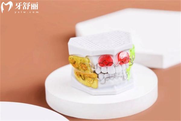 Frankel功能矫治器