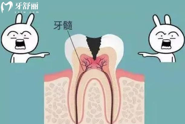 显微根管治疗的优点和缺点