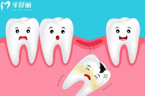 40岁缺牙导致后面牙齿倾斜怎么办