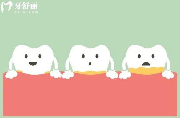 牙齿上有牙菌斑怎么去除