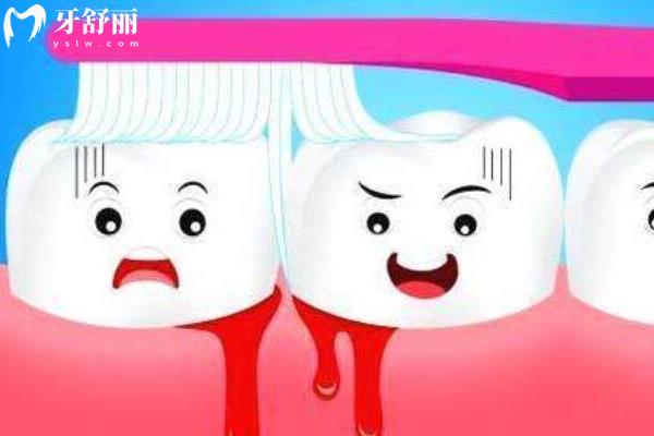 牙周炎一辈子都治不好吗? 牙周炎一辈子都治不好吗?