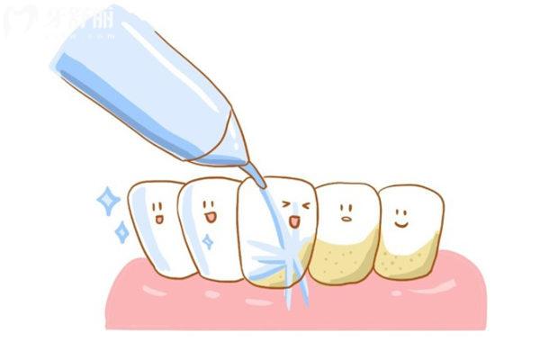 洗牙出血的常见原因