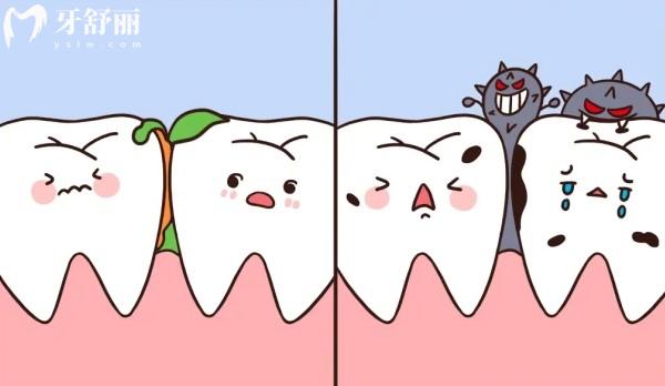 儿童换牙前龋齿需要治疗吗