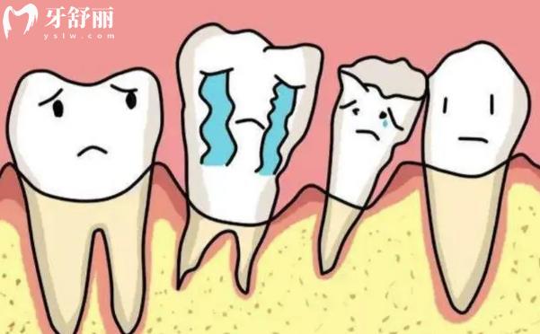 牙周炎会导致年纪轻轻掉牙吗