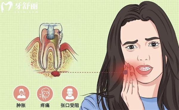 牙龈发炎肿痛应该注意些什么