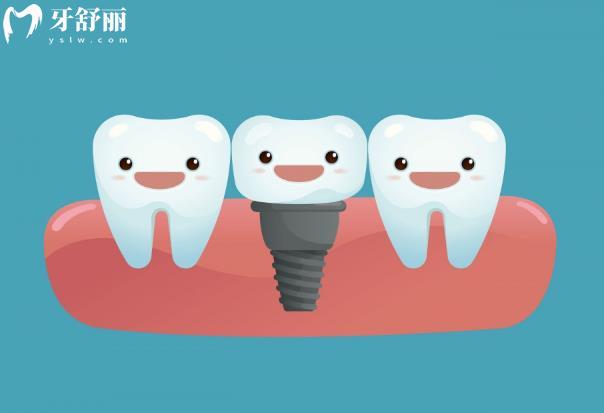 仿生牙和种植牙/活动假牙的区别,来看看有什么不同哪个好