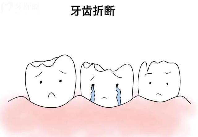 牙齿被撞断后怎么处理比较好