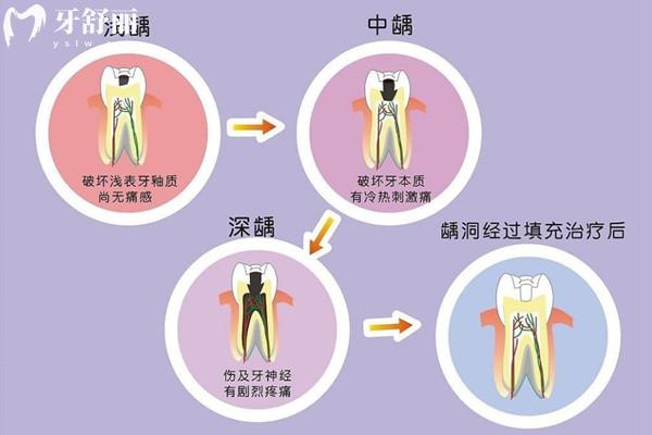 诸暨看牙收费标准