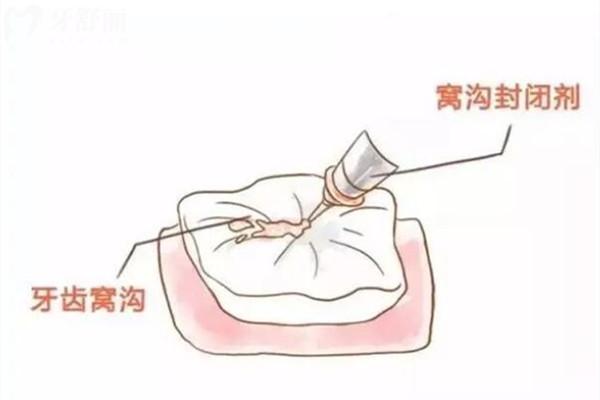 诸暨看牙收费标准