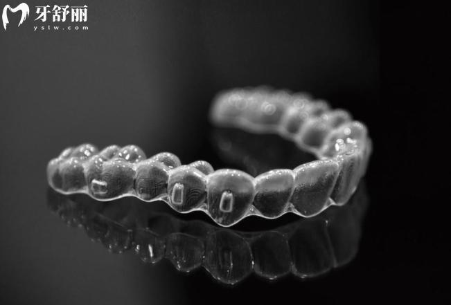 可丽尔隐形矫正好不好