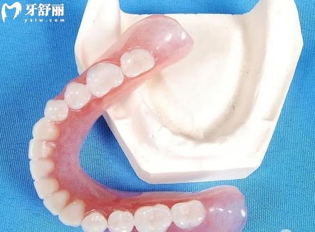 德国无挂钩镶牙靠谱吗