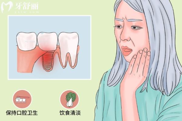 种植牙 (5).jpg
