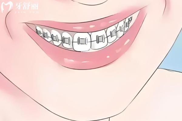 长春做矫正牙齿正规的口腔医院