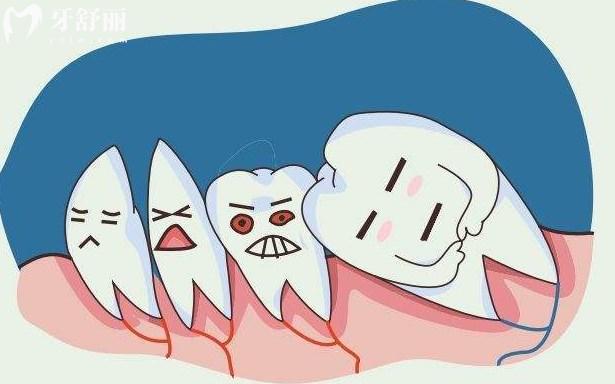 智齿烂个洞是拔还是补