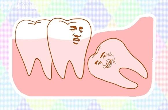 什么是智齿？