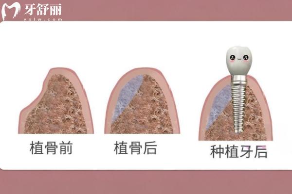 兴隆台诺亚口腔怎么样？