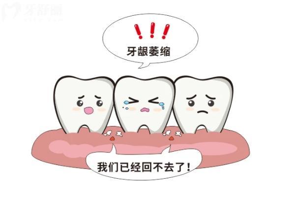 龋齿导致的牙龈萎缩怎么办？来看看有什么好方法治疗