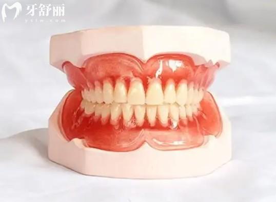 吸附性义齿真的那么好吗