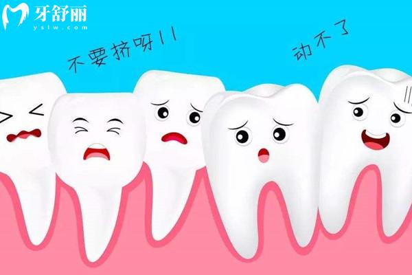 牙齿矫正26岁还来得及吗