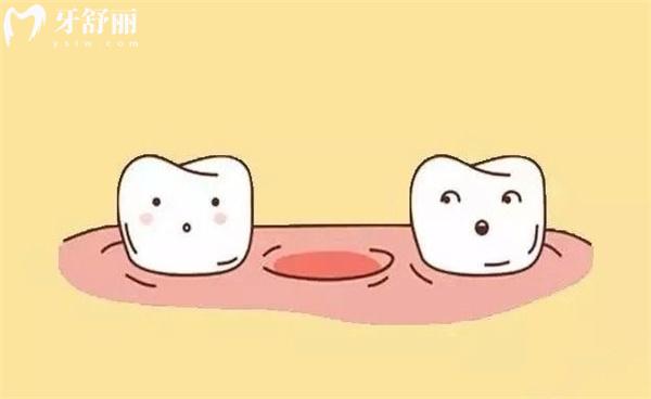 当牙齿掉光对身体的危害有哪些