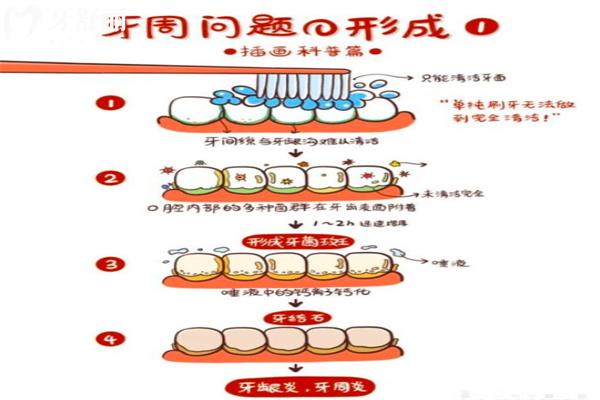 牙龈一吸就出血是怎么回事?