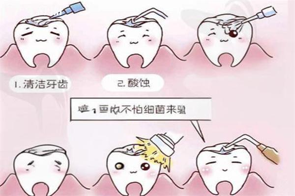 牙齿烂了个洞怎么处理