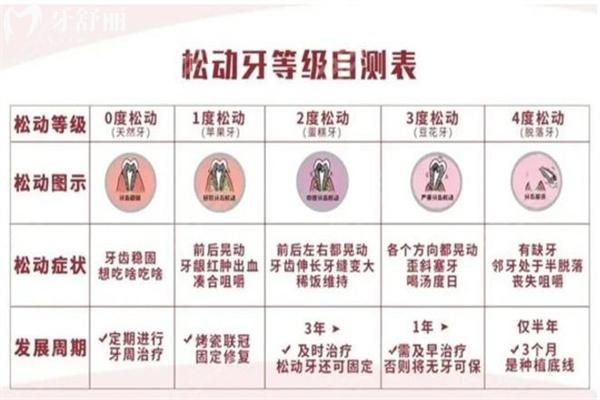 分享牙松动等级的分类方法及松动牙齿怎么处理的办法