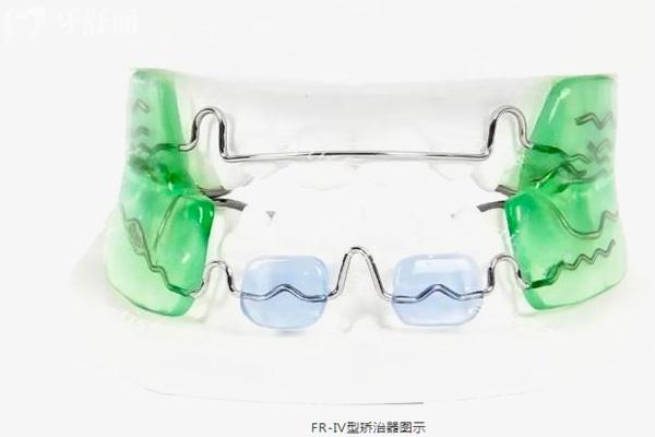 呼和浩特正规口腔医院2025收费标准已出:种植牙1980+牙齿矫正5800+