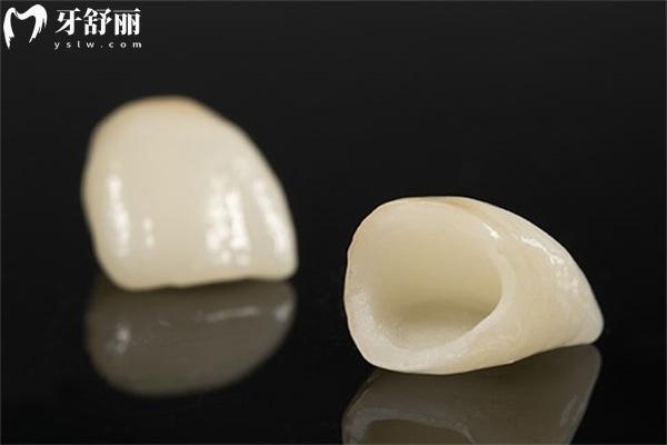 假牙哪种材质便宜还实用?这四大假牙类型及其适用人群和价格参考下