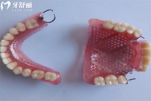 假牙哪种材质便宜还实用?这四大假牙类型及其适用人群和价格参考下