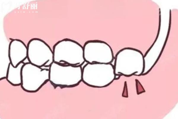 长沙口腔医院收费价目表查询