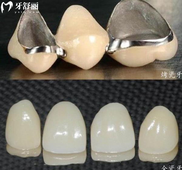 南京牙科医院收费标准