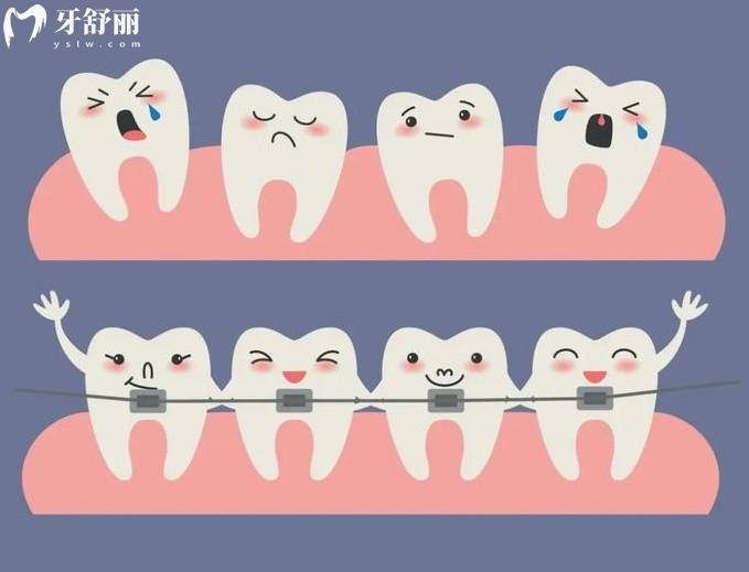 惠州口腔医院牙齿矫正多少钱
